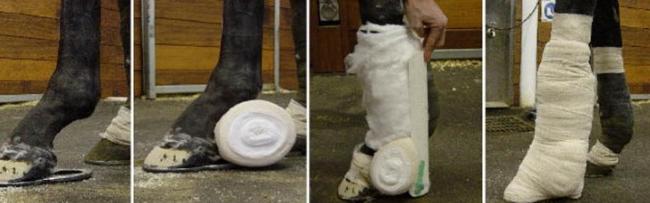 sciencedirect com "modified shoe splint combination"